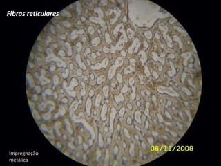 Fibras reticularesImpregnação metálica