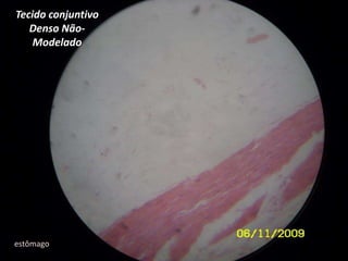 Tecido conjuntivo Denso Não-Modeladoestômago