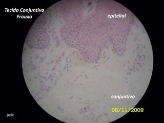 Tecido Conjuntivo Frouxoepitelialconjuntivopele