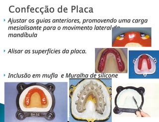  Ajustar os guias anteriores, promovendo uma carga
mesialisante para o movimento lateral da
mandíbula
 Alisar as superfícies da placa.
 Inclusão em mufla e Muralha de silicone
 