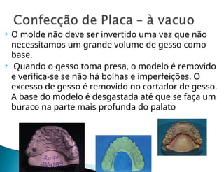  O molde não deve ser invertido uma vez que não
necessitamos um grande volume de gesso como
base.
 Quando o gesso toma presa, o modelo é removido
e verifica-se se não há bolhas e imperfeições. O
excesso de gesso é removido no cortador de gesso.
A base do modelo é desgastada até que se faça um
buraco na parte mais profunda do palato
 