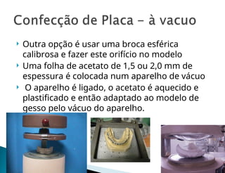  Outra opção é usar uma broca esférica
calibrosa e fazer este orifício no modelo
 Uma folha de acetato de 1,5 ou 2,0 mm de
espessura é colocada num aparelho de vácuo
 O aparelho é ligado, o acetato é aquecido e
plastificado e então adaptado ao modelo de
gesso pelo vácuo do aparelho.
 