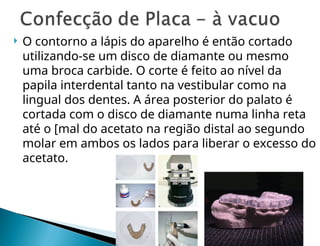  O contorno a lápis do aparelho é então cortado
utilizando-se um disco de diamante ou mesmo
uma broca carbide. O corte é feito ao nível da
papila interdental tanto na vestibular como na
lingual dos dentes. A área posterior do palato é
cortada com o disco de diamante numa linha reta
até o [mal do acetato na região distal ao segundo
molar em ambos os lados para liberar o excesso do
acetato.
 