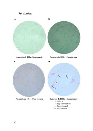 100
Resultados:
A. B.
Aumento de 400x - Sem corante Aumento de 1000x – Sem corante
C. D.
Aumento de 400x – Com corante Aumento de 1000x – Com corante
1- Cabeça
2- Peça intermediária
3- Peça principal
4- Peça terminal
 