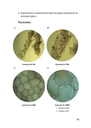 6. Esquematizar o material observado nos quatro aumentos do mi-
croscópio óptico.
Resultados:
A. B.
Aumento de 40x Aumento de 100x
C. D.
Aumento de 400x Aumento de 1000x
1- Parede celular
2- Espaço vazio
15
 