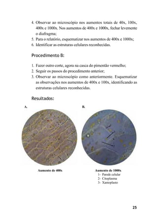 25
4. Observar ao microscópio nos aumentos totais de 40x, 100x,
400x e 1000x. Nos aumentos de 400x e 1000x, fechar levemente
o diafragma;
5. Para o relatório, esquematizar nos aumentos de 400x e 1000x;
6. Identificar as estruturas celulares reconhecidas.
Procedimento B:
1. Fazer outro corte, agora na casca do pimentão vermelho;
2. Seguir os passos do procedimento anterior;
3. Observar ao microscópio como anteriormente. Esquematizar
as observações nos aumentos de 400x e 100x, identificando as
estruturas celulares reconhecidas.
Resultados:
A. B.
Aumento de 400x Aumento de 1000x
1- Parede celular
2- Citoplasma
3- Xantoplasto
 
