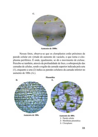33
C.
Aumento de 1000x
Nessas fotos, observa-se que os cloroplastos estão próximos da
parede celular em virtude do aumento do vacúolo, o que torna o cito-
plasma periférico. É onde, igualmente, se dá o movimento de ciclose.
Percebe-se também, através da profundidade de foco, a sobreposição das
camadas de células, sendo a região da camada superior indicada pela seta
(1), enquanto a seta (2) indica as paredes celulares da camada inferior no
aumento de 100x (A.).
Plasmólise
D. E.
Aumento de 100x Aumento de 400x
1- Parede celular
2- Membrana plasmática
3- Cloroplasto
 