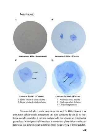 Resultados:
A. B.
Aumento de 400x – Sem corante Aumento de 100x – Corante
C. D.
Aumento de 400x – Corante
1- Limite celular da célula de cima
2- Limite celular da célula de baixo
Aumento de 1000x - Corante
1 - Núcleo da célula de cima
2 - Núcleo da célula de baixo
3 - Citoplasma granuloso
No material não corado, com aumento total de 400x (foto A.), as
estruturas celulares não apresentam um bom contraste de cor. Já no ma-
terial corado, o núcleo é melhor evidenciado em relação ao citoplasma
granuloso. Não é possível visualizar a membrana plasmática em decor-
rência de sua espessura ser ultrafina: então o que se vê é o limite celular.
49
 