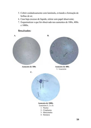5. Cobrir cuidadosamente com lamínula, evitando a formação de
bolhas de ar;
6. Caso haja excesso de líquido, retirar com papel absorvente;
7. Esquematizar o que for observado nos aumentos de 100x, 400x
e 1000x.
Resultados:
A. B.
Aumento de 100x Aumento de 400x
1- Leucócito
C.
Aumento de 1000x
Leucócito (1, 2 e 3)
1- Núcleo
2- Citoplasma
3- Mitocôndria
4- Hemácia
59
 