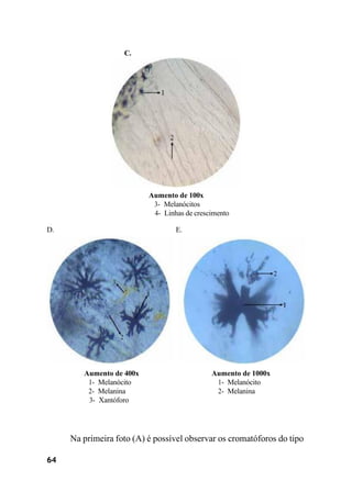 64
C.
Aumento de 100x
3- Melanócitos
4- Linhas de crescimento
D. E.
Aumento de 400x
1- Melanócito
2- Melanina
3- Xantóforo
Aumento de 1000x
1- Melanócito
2- Melanina
Na primeira foto (A) é possível observar os cromatóforos do tipo
 