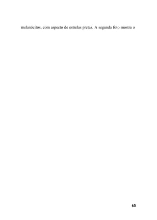 65
melanócitos, com aspecto de estrelas pretas. A segunda foto mostra o
 