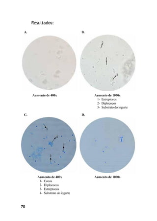 70
Resultados:
A. B.
Aumento de 400x Aumento de 1000x
1- Estreptocos
2- Diplococos
3- Substrato do iogurte
C. D.
Aumento de 400x
1- Cocos
2- Diplococos
3- Estreptocos
4- Substrato do iogurte
Aumento de 1000x
 