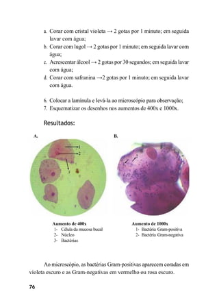76
a. Corar com cristal violeta → 2 gotas por 1 minuto; em seguida
lavar com água;
b. Corar com lugol → 2 gotas por 1 minuto; em seguida lavar com
água;
c. Acrescentar álcool → 2 gotas por 30 segundos; em seguida lavar
com água;
d. Corar com safranina →2 gotas por 1 minuto; em seguida lavar
com água.
6. Colocar a lamínula e levá-la ao microscópio para observação;
7. Esquematizar os desenhos nos aumentos de 400x e 1000x.
Resultados:
A. B.
Aumento de 400x
1- Célula da mucosa bucal
2- Núcleo
3- Bactérias
Aumento de 1000x
1- Bactéria Gram-positiva
2- Bactéria Gram-negativa
Ao microscópio, as bactérias Gram-positivas aparecem coradas em
violeta escuro e as Gram-negativas em vermelho ou rosa escuro.
 