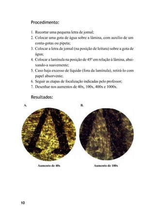 10
Procedimento:
1. Recortar uma pequena letra de jornal;
2. Colocar uma gota de água sobre a lâmina, com auxílio de um
conta-gotas ou pipeta;
3. Colocar a letra de jornal (na posição de leitura) sobre a gota de
água;
4. Colocar a lamínula na posição de 45º em relação à lâmina, abai-
xando-a suavemente;
5. Caso haja excesso de líquido (fora da lamínula), retirá-lo com
papel absorvente;
6. Seguir as etapas de focalização indicadas pelo professor;
7. Desenhar nos aumentos de 40x, 100x, 400x e 1000x.
Resultados:
A. B.
Aumento de 40x Aumento de 100x
 