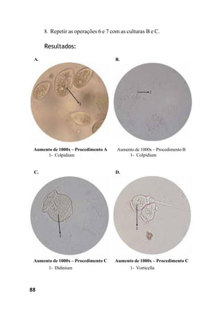 88
8. Repetir as operações 6 e 7 com as culturas B e C.
Resultados:
A. B.
Aumento de 1000x – Procedimento A
1- Colpidium
Aumento de 1000x – Procedimento B
1- Colpidium
C. D.
Aumento de 1000x – Procedimento C
1- Didinium
Aumento de 1000x – Procedimento C
1- Vorticella
 