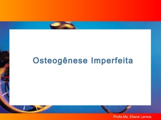 Osteogênese Imperfeita 