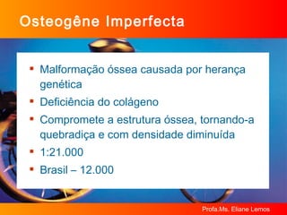 Osteogêne Imperfecta Malformação óssea causada por herança genética Deficiência do colágeno Compromete a estrutura óssea, tornando-a quebradiça e com densidade diminuída 1:21.000 Brasil – 12.000 