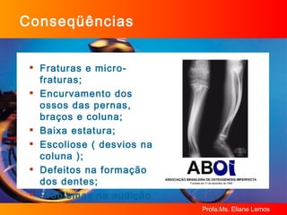 Conseqüências Fraturas e micro-fraturas; Encurvamento dos ossos das pernas, braços e coluna; Baixa estatura; Escoliose ( desvios na coluna );  Defeitos na formação dos dentes; Problemas na audição. 