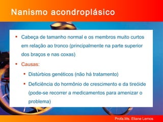 Nanismo acondroplásico Cabeça de tamanho normal e os membros muito curtos em relação ao tronco (principalmente na parte superior dos braços e nas coxas) Causas: Distúrbios genéticos (não há tratamento) Deficiência do hormônio de crescimento e da tireóide (pode-se recorrer a medicamentos para amenizar o problema) 