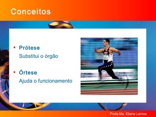 Conceitos Prótese  Substitui o órgão Órtese   Ajuda o funcionamento 