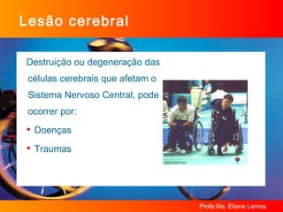Lesão cerebral Destruição ou degeneração das células cerebrais que afetam o Sistema Nervoso Central, pode ocorrer por: Doenças Traumas 