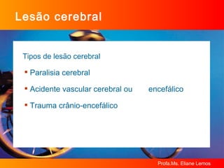 Lesão cerebral Tipos de lesão cerebral Paralisia cerebral Acidente vascular cerebral ou encefálico Trauma crânio-encefálico 