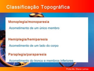 Classificação Topográfica Monoplegia/monoparesia Acometimento de um único membro Hemiplegia/hemiparesia Acometimento de um lado do corpo Paraplegia/paraparesia Acometimento do tronco e membros inferiores 