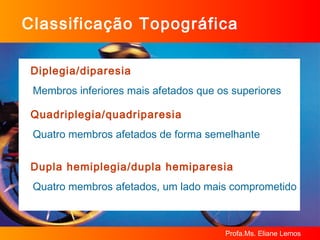 Classificação Topográfica Diplegia/diparesia Membros inferiores mais afetados que os superiores Quadriplegia/quadriparesia Quatro membros afetados de forma semelhante Dupla hemiplegia/dupla hemiparesia Quatro membros afetados, um lado mais comprometido 