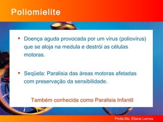 Poliomielite Doença aguda provocada por um vírus (poliovírus) que se aloja na medula e destrói as células motoras. Seqüela: Paralisia das áreas motoras afetadas com preservação da sensibilidade. Também conhecida como Paralisia Infantil 