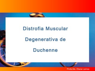 Distrofia Muscular Degenerativa de Duchenne 