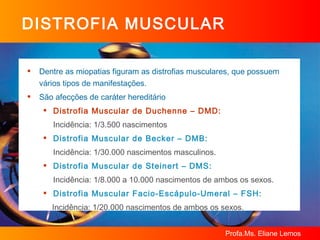 DISTROFIA MUSCULAR Dentre as miopatias figuram as distrofias musculares, que possuem vários tipos de manifestações. São afecções de caráter hereditário  Distrofia Muscular de Duchenne – DMD:  Incidência: 1/3.500 nascimentos Distrofia Muscular de Becker – DMB:   Incidência: 1/30.000 nascimentos masculinos. Distrofia Muscular de Steinert – DMS: Incidência: 1/8.000 a 10.000 nascimentos de ambos os sexos. Distrofia Muscular Facio-Escápulo-Umeral – FSH:   Incidência: 1/20.000 nascimentos de ambos os sexos.  