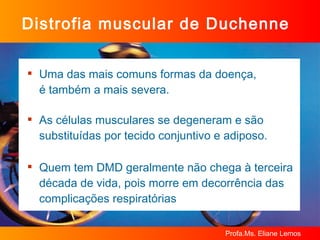 Distrofia muscular de Duchenne Uma das mais comuns formas da doença,  é também a mais severa. As células musculares se degeneram e são substituídas por tecido conjuntivo e adiposo. Quem tem DMD geralmente não chega à terceira década de vida, pois morre em decorrência das complicações respiratórias 