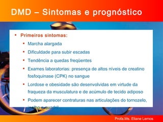 DMD – Sintomas e prognóstico Primeiros sintomas: Marcha alargada Dificuldade para subir escadas Tendência a quedas freqüentes Exames laboratorias: presença de altos níveis de creatino fosfoquinase (CPK) no sangue Lordose e obesidade são desenvolvidas em virtude da fraqueza da musculatura e de acúmulo de tecido adiposo Podem aparecer contraturas nas articulações do tornozelo, joelho e quadril 
