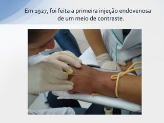Em 1927, foi feita a primeira injeção endovenosa
de um meio de contraste.
 