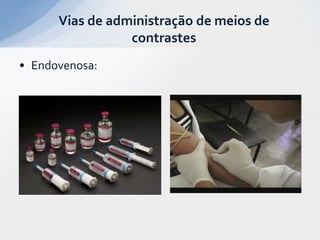 • Endovenosa:
Vias de administração de meios de
contrastes
 