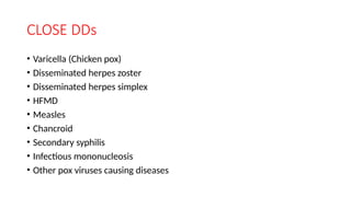 CLOSE DDs
• Varicella (Chicken pox)
• Disseminated herpes zoster
• Disseminated herpes simplex
• HFMD
• Measles
• Chancroid
• Secondary syphilis
• Infectious mononucleosis
• Other pox viruses causing diseases
 