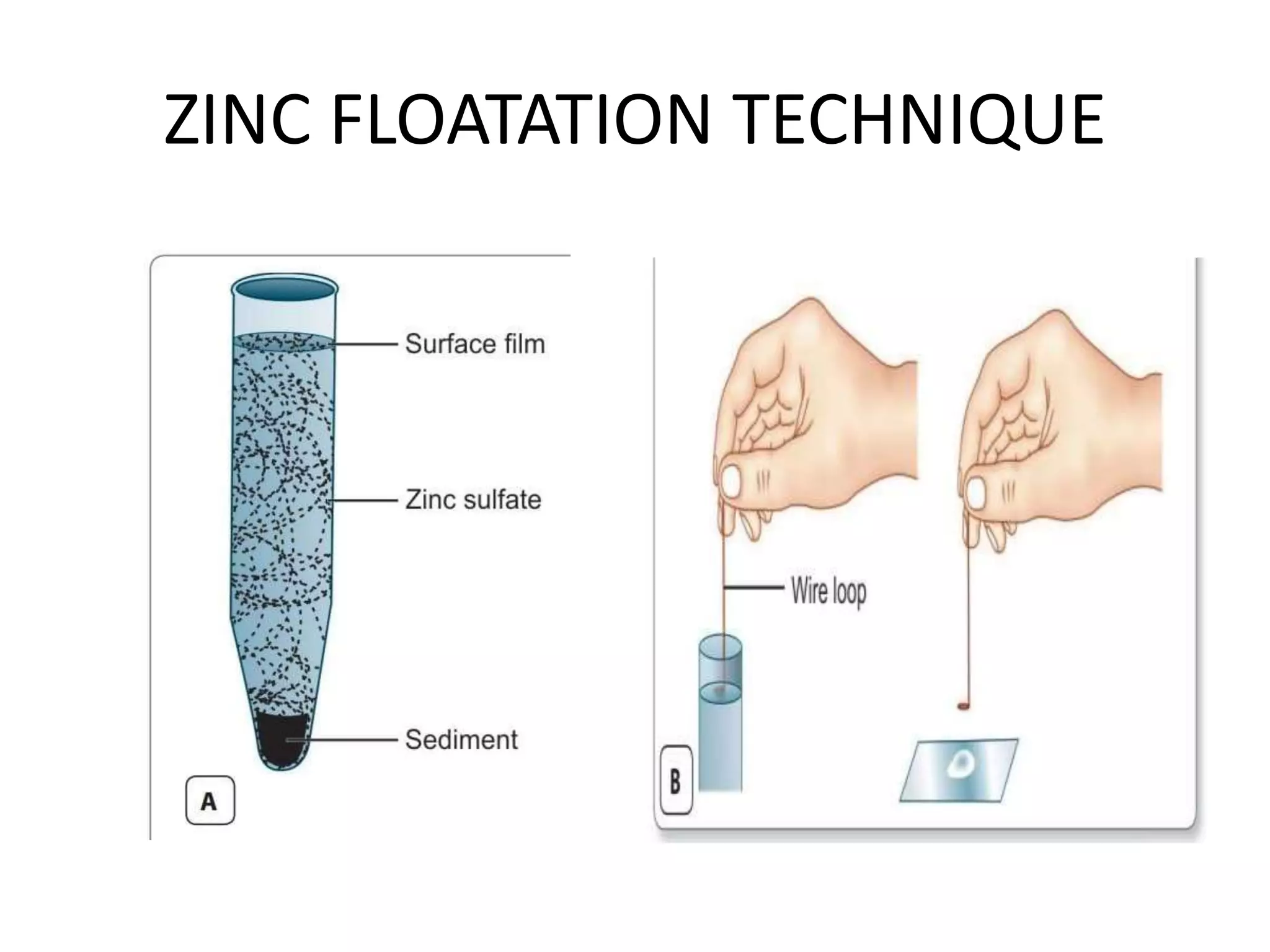 ZINC FLOATATION TECHNIQUE
 