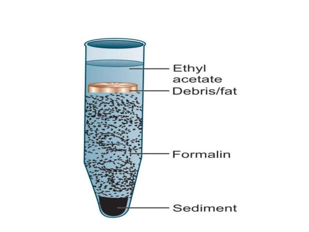 STOOL CONCENTRATION METHODS | PPTX | First Aid | Injuries