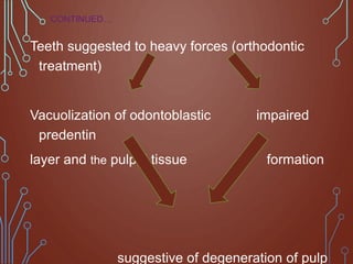 Teeth suggested to heavy forces (orthodontic
treatment)
Vacuolization of odontoblastic impaired
predentin
layer and the pulpal tissue formation
suggestive of degeneration of pulp
CONTINUED…
 