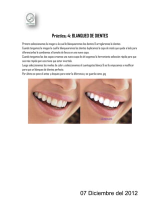 Práctica,-4: BLANQUEO DE DIENTES
Primero seleccionamos la imagen a la cual le blanquearemos los dientes & arreglaremos lo dientes.
Cuando tengamos la imagen la cual le blanquearemos los dientes duplicamos la capa de modo que quede a lado para
diferenciarlas le cambiamos el tamaño de lienzo en una nueva capa.
Cuando tengamos las dos capas creamos una nueva capa de ahí cogemos la herramienta selección rápida para que
sea más rápido para eso tiene que estar invertida.
Luego seleccionamos los niveles de color y seleccionamos el cuentagotas blanco & así lo empezamos a modificar
para que un blanqueo de dientes perfecto.
Por último se pone el antes y después para notar la diferencia y se guarda como .jpg




                                                        07 Diciembre del 2012
 