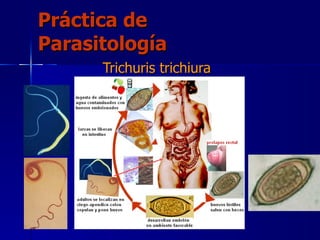Práctica de Parasitología Trichuris trichiura   