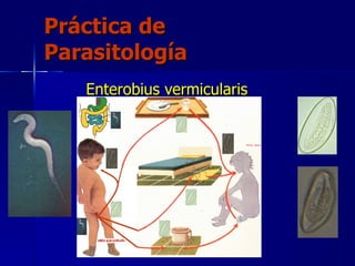 Práctica de Parasitología Enterobius vermicularis 