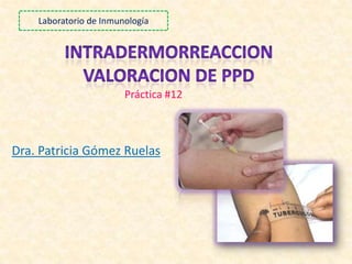 Laboratorio de Inmunología
Dra. Patricia Gómez Ruelas
Práctica #12
 