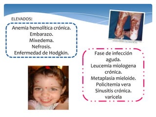 ELEVADOS:
Anemia hemolítica crónica.
Embarazo.
Mixedema.
Nefrosis.
Enfermedad de Hodgkin. Fase de infección
aguda.
Leucemia miologena
crónica.
Metaplasia mieloide.
Policitemia vera
Sinusitis crónica.
varicela
 