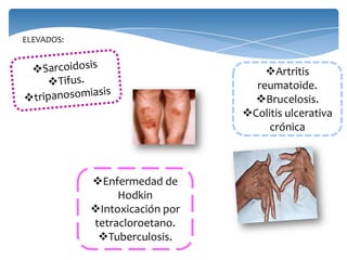 ELEVADOS:
Enfermedad de
Hodkin
Intoxicación por
tetracloroetano.
Tuberculosis.
Artritis
reumatoide.
Brucelosis.
Colitis ulcerativa
crónica
 