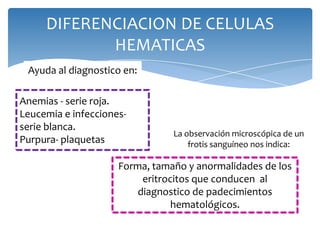 DIFERENCIACION DE CELULAS
HEMATICAS
Anemias - serie roja.
Leucemia e infecciones-
serie blanca.
Purpura- plaquetas
Ayuda al diagnostico en:
La observación microscópica de un
frotis sanguíneo nos indica:
Forma, tamaño y anormalidades de los
eritrocitos que conducen al
diagnostico de padecimientos
hematológicos.
 