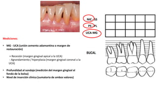 Mediciones:
• MG - UCA (unión cemento adamantina o margen de
restauración)
+ Recesión (margen gingival apical a la UCA)
- Agrandamiento / hiperplasia (margen gingival coronal a la
UCA)
• Profundidad al sondaje (medición del margen gingival al
fondo de la bolsa)
• Nivel de inserción clínica (sumatoria de ambos valores)
 