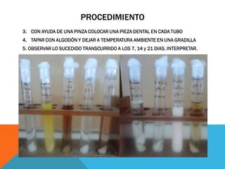 PROCEDIMIENTO
3. CON AYUDA DE UNA PINZA COLOCAR UNA PIEZA DENTAL EN CADA TUBO
4. TAPAR CON ALGODÓN Y DEJAR A TEMPERATURA AMBIENTE EN UNA GRADILLA
5. OBSERVAR LO SUCEDIDO TRANSCURRIDO A LOS 7, 14 y 21 DIAS. INTERPRETAR.
 