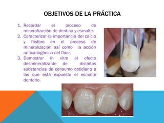 OBJETIVOS DE LA PRÁCTICA
1. Recordar el proceso de
mineralización de dentina y esmalte.
2. Caracterizar la importancia del calcio
y fósforo en el proceso de
mineralización así como la acción
anticariogénica del flúor.
3. Demostrar in vitro el efecto
desmineralizante de distintas
substancias de consumo cotidiano a
las que está expuesto el esmalte
dentario.
 