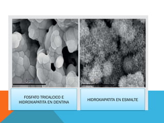 FOSFATO TRICALCICO E
HIDROXIAPATITA EN DENTINA
HIDROXIAPATITA EN ESMALTE
 